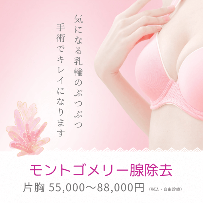 モントゴメリー腺除去